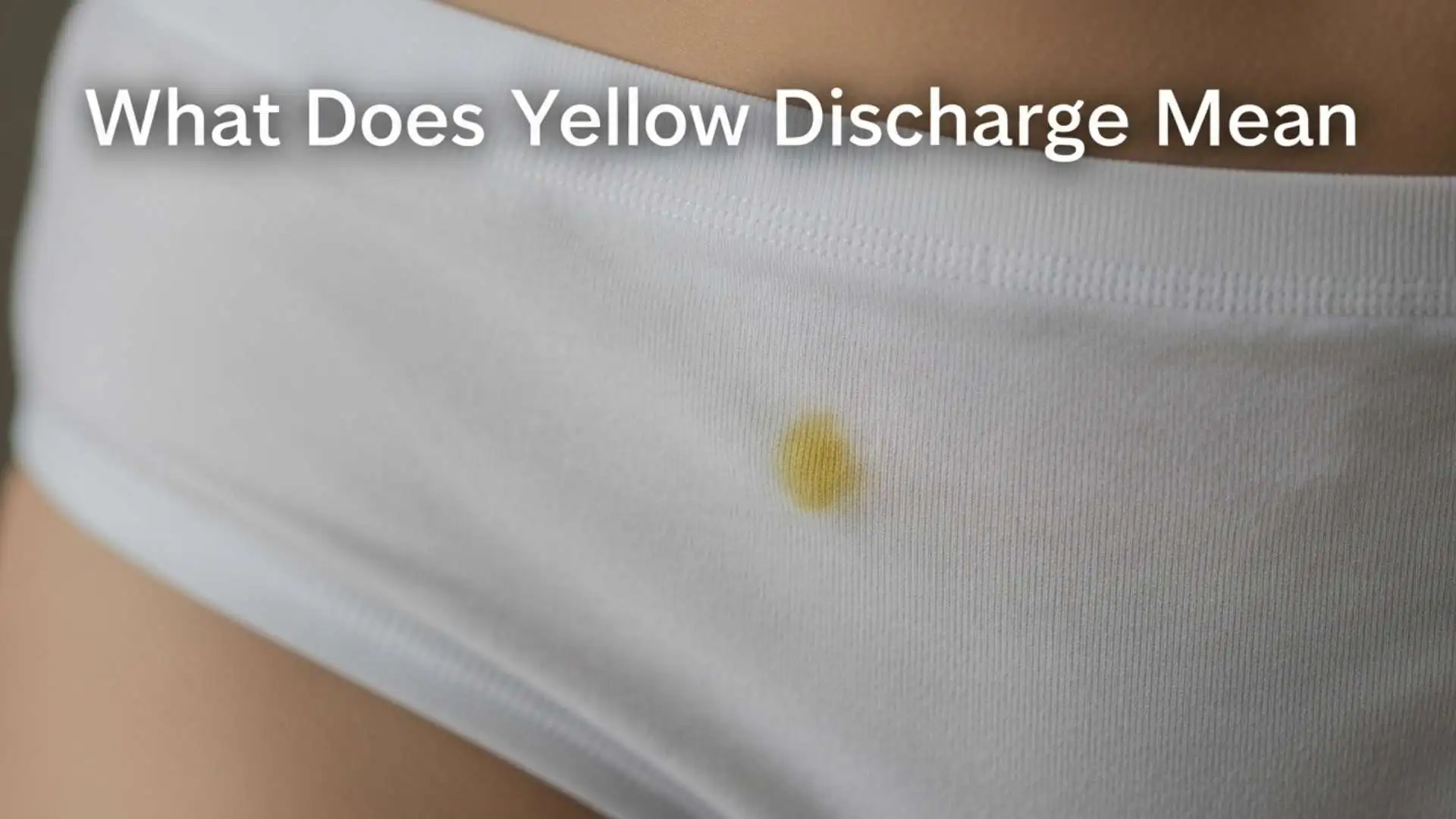What Does Yellow Discharge Mean? Hidden Causes, Warning Signs & When You Should Worry