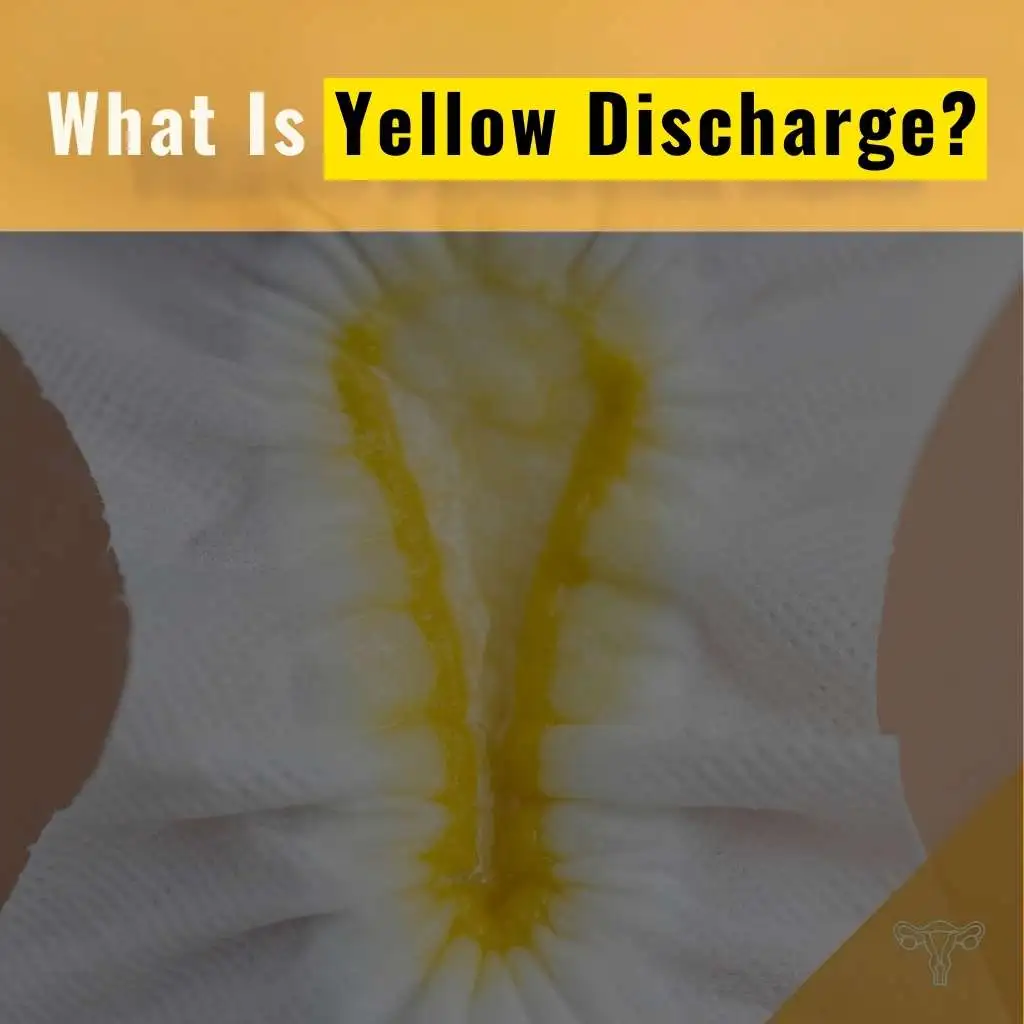 What Is Yellow Discharge